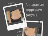 Массаж, лфк, аппаратная коррекция фигуры - fotosurat 3